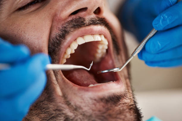 Best Emergency Orthodontic Services in Saucier, MS