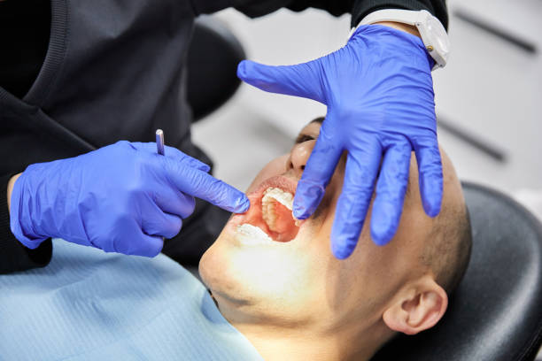 Best Emergency Denture Repair in Saucier, MS